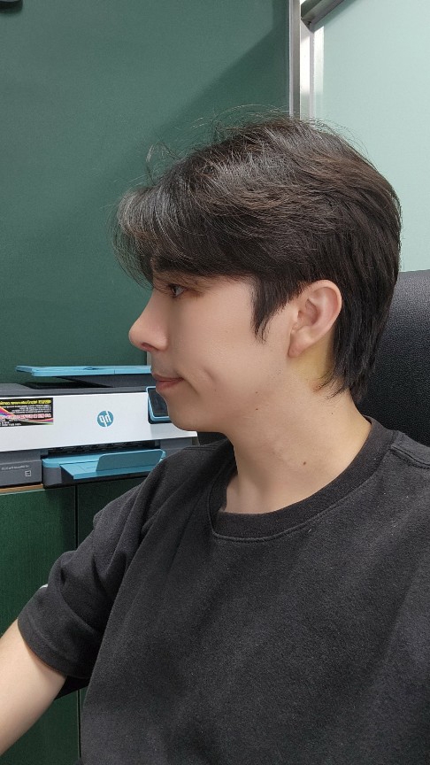 수술후기이미지