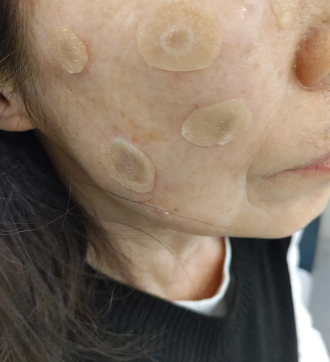 수술후기이미지