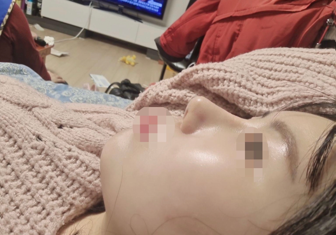 수술후기이미지