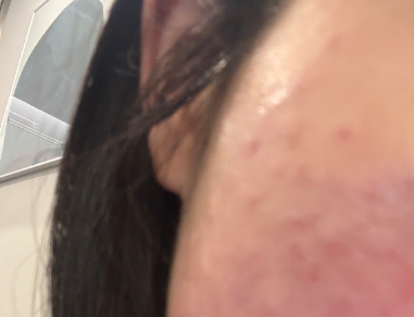 수술후기이미지