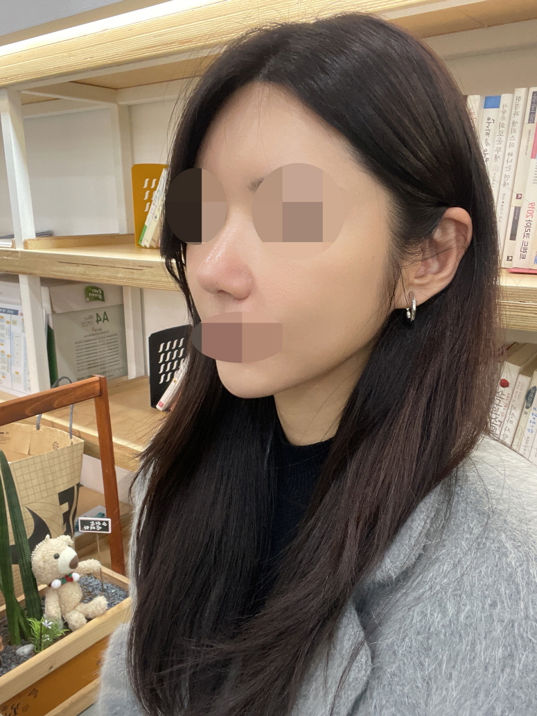 수술후기이미지