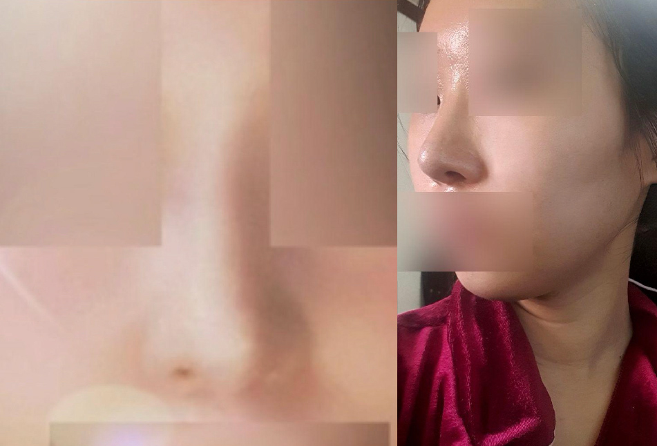 수술후기이미지