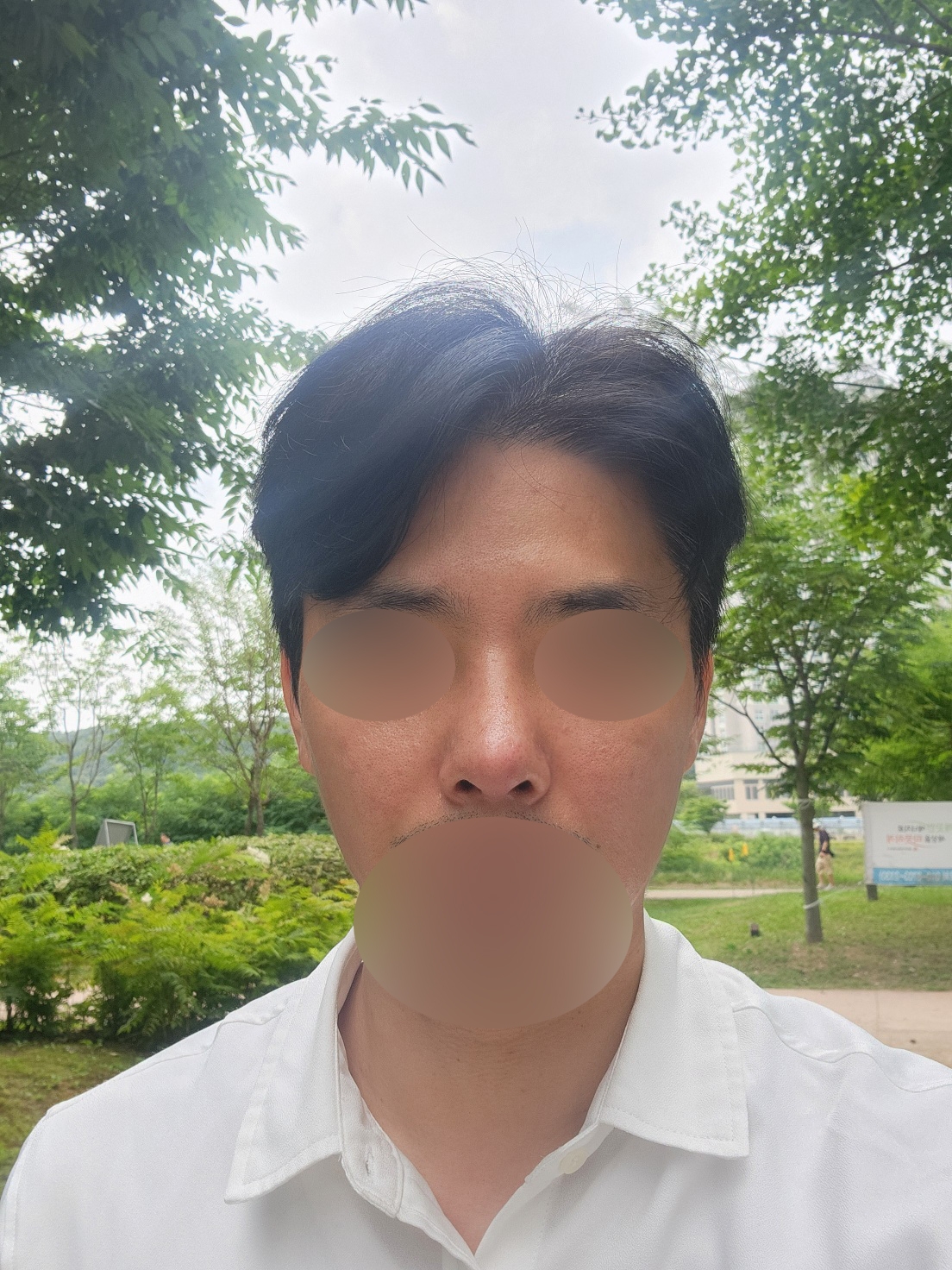 수술후기이미지