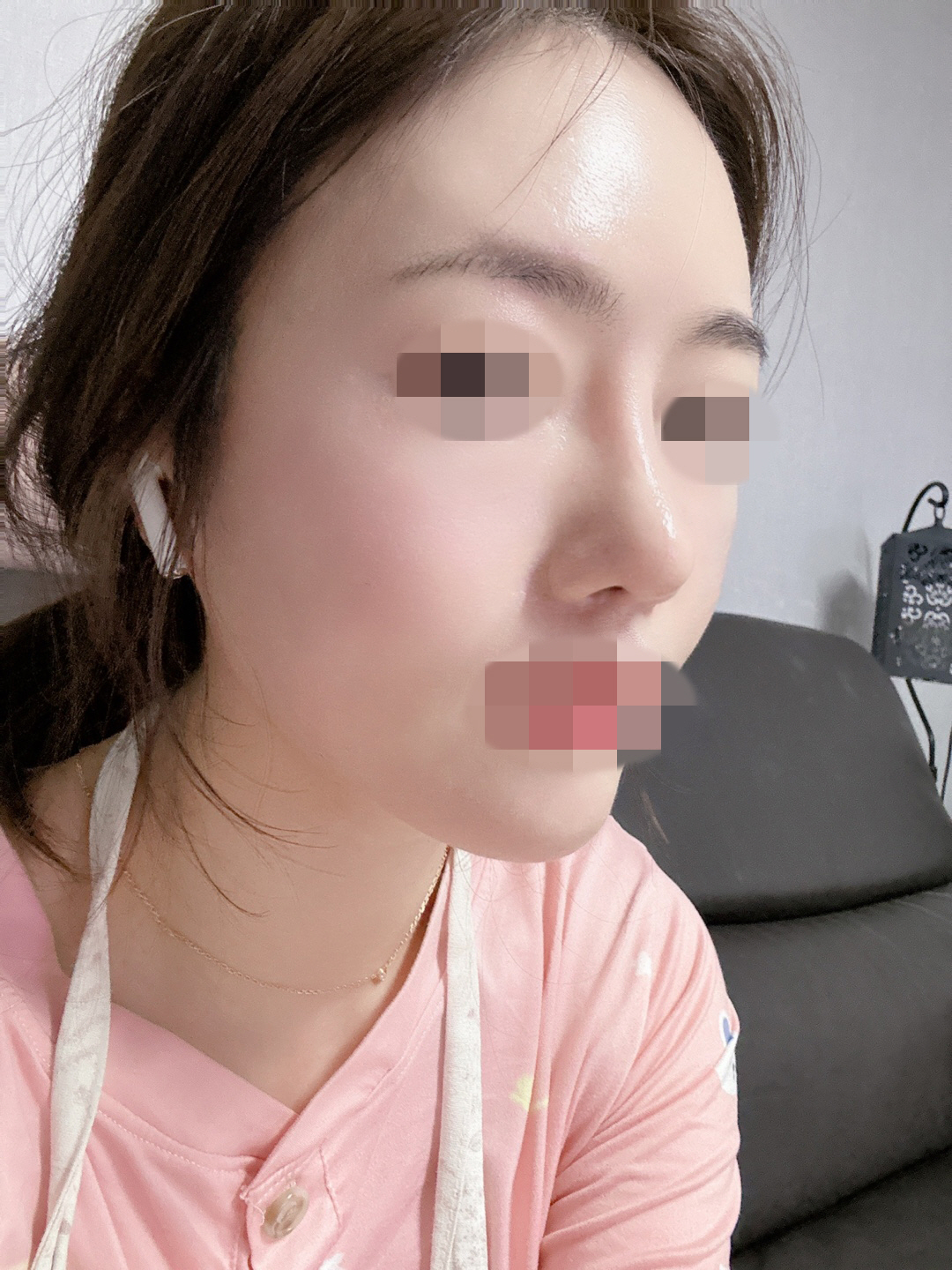 수술후기이미지