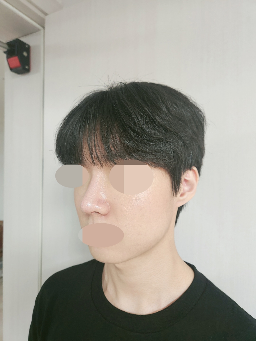 수술후기이미지