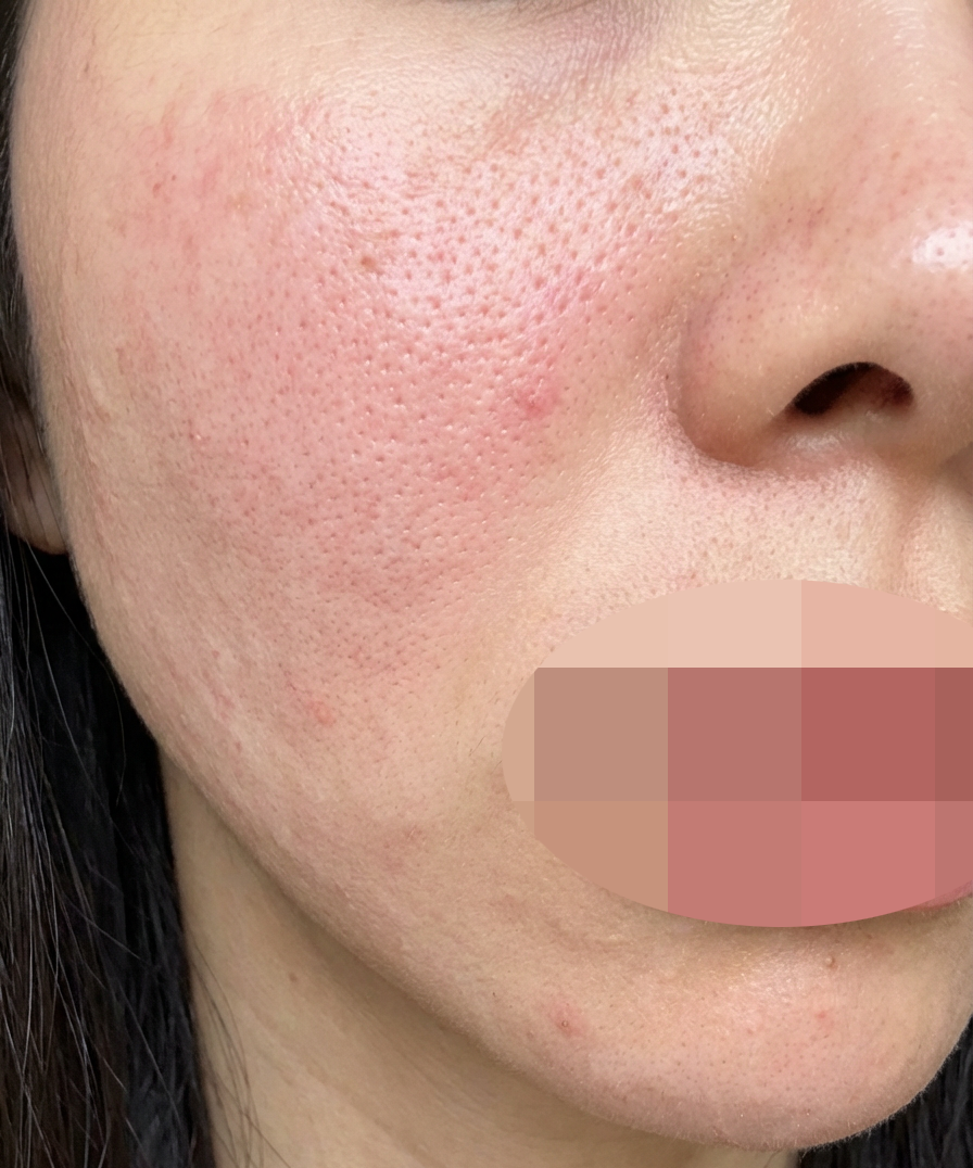 수술후기이미지