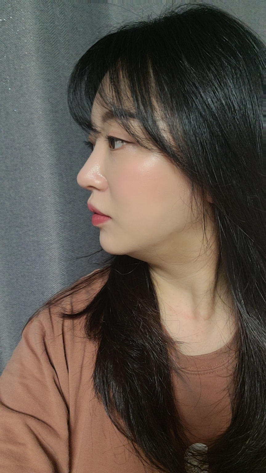 수술후기이미지