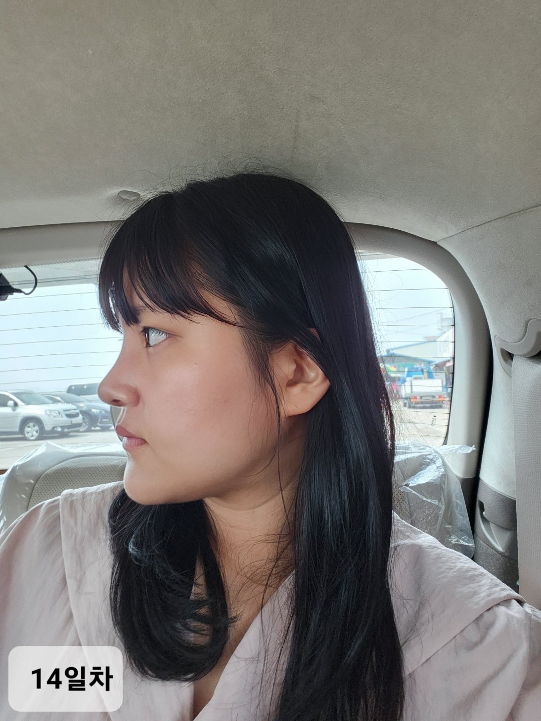 수술후기이미지