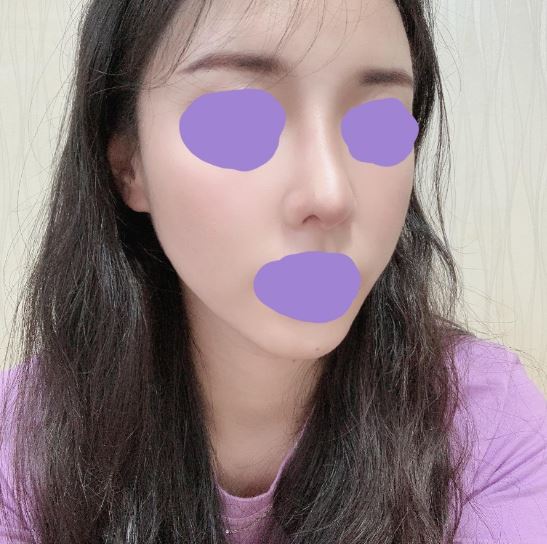 수술후기이미지