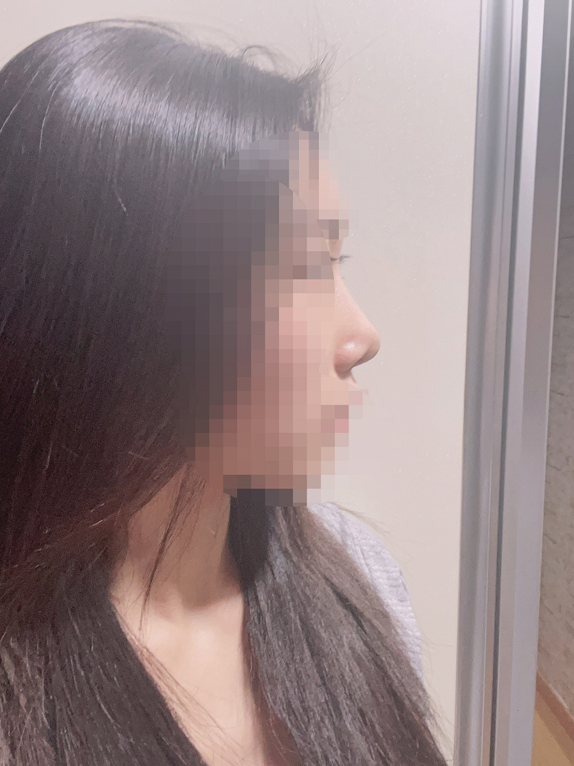 수술후기이미지