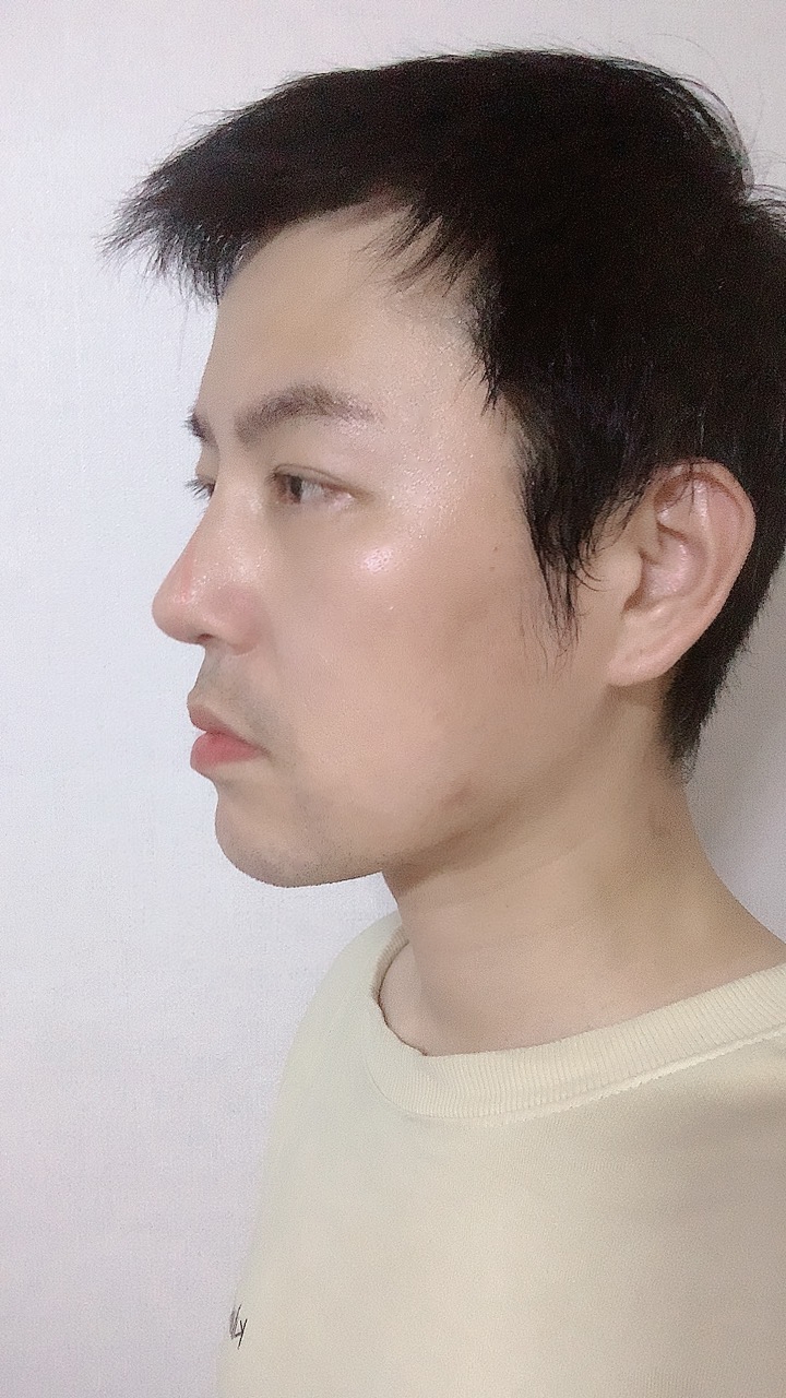 수술후기이미지