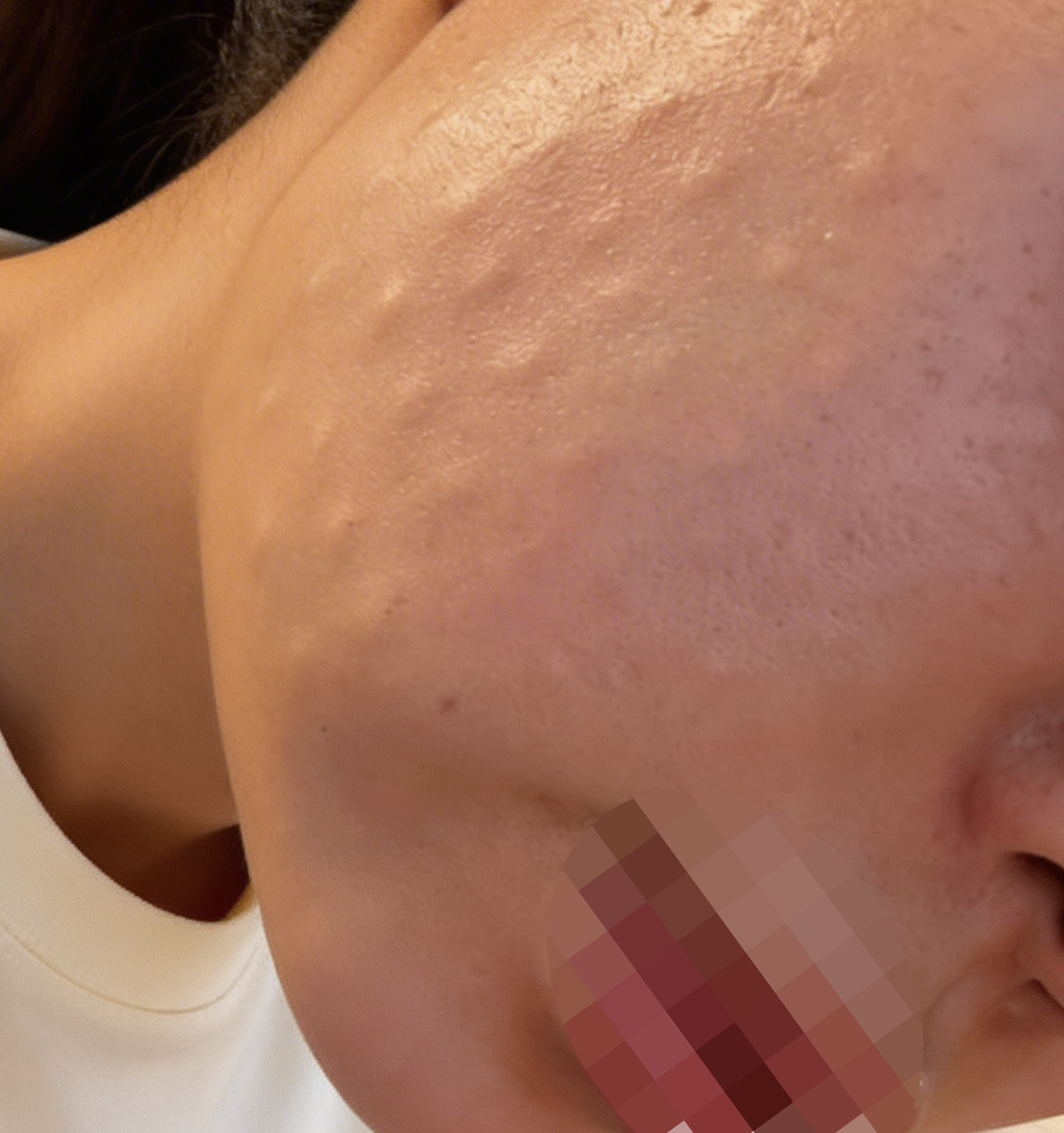 수술후기이미지