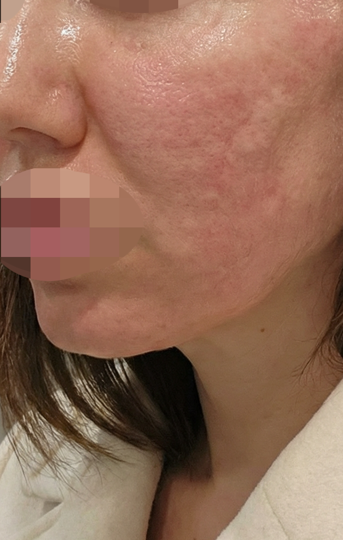 수술후기이미지