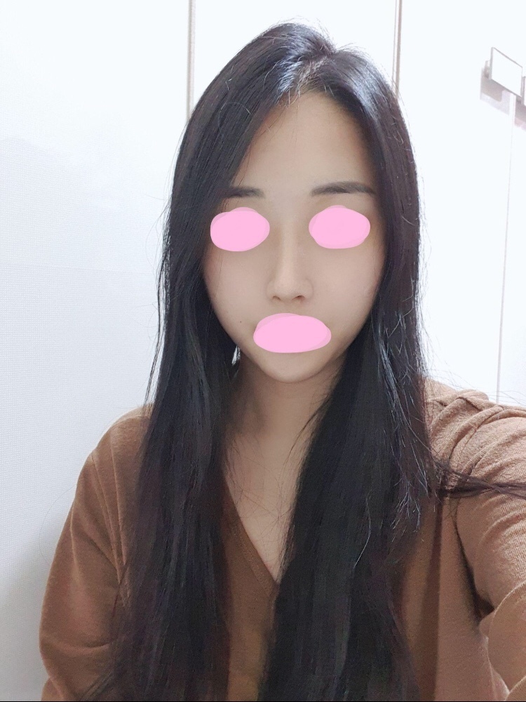 수술후기이미지