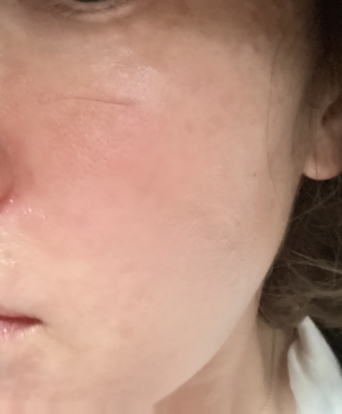 수술후기이미지