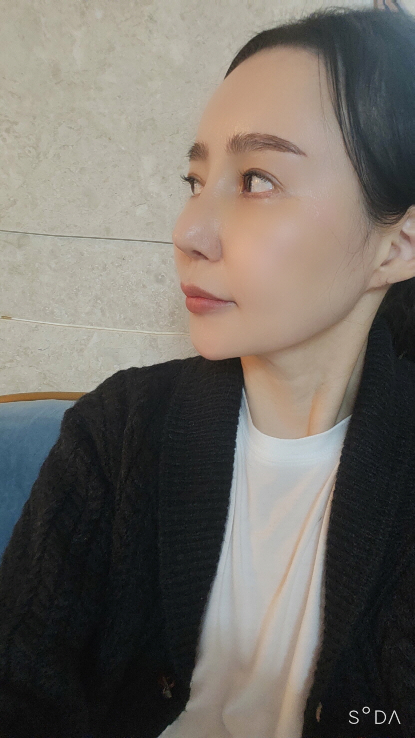 수술후기이미지