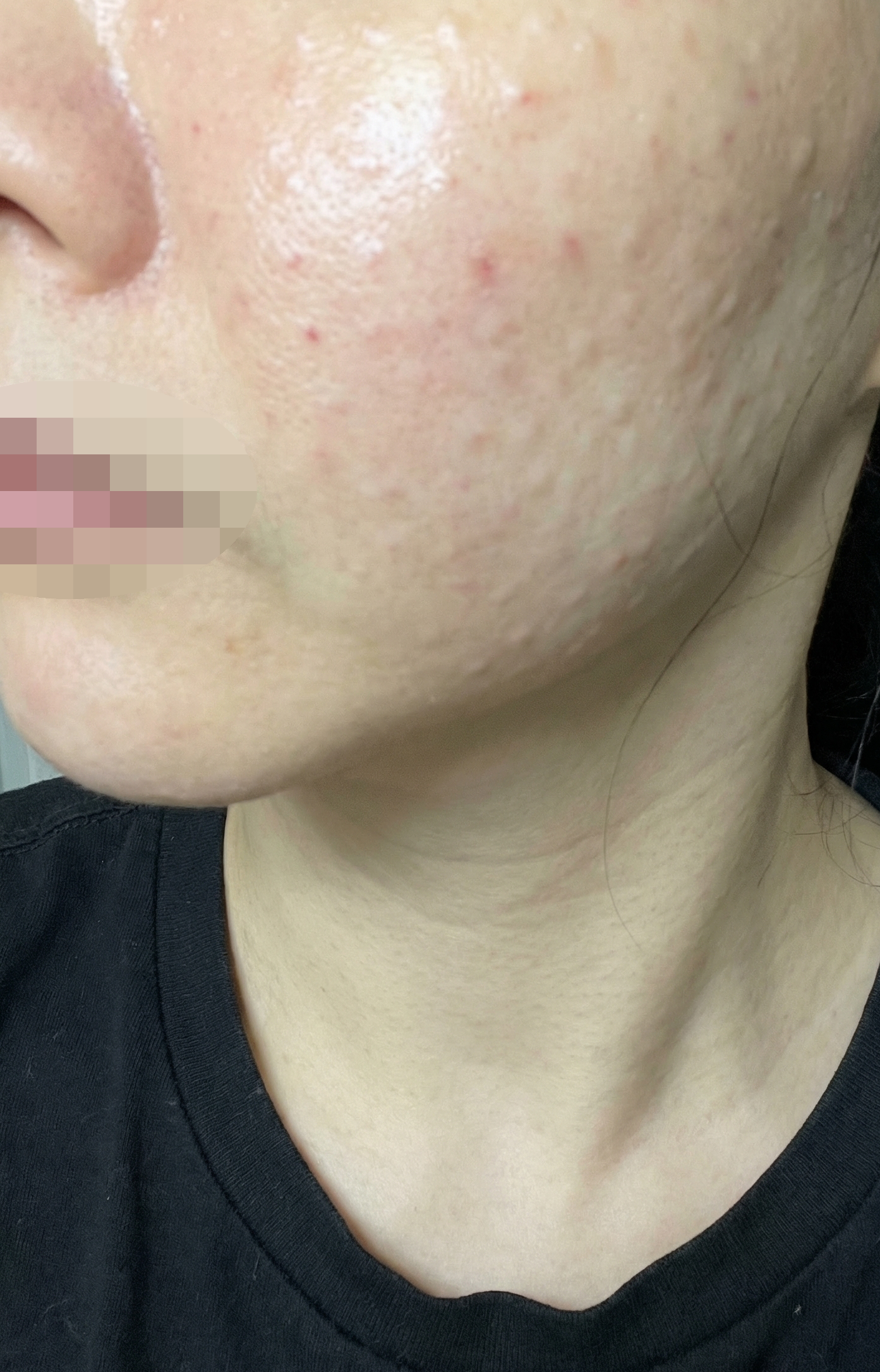 수술후기이미지