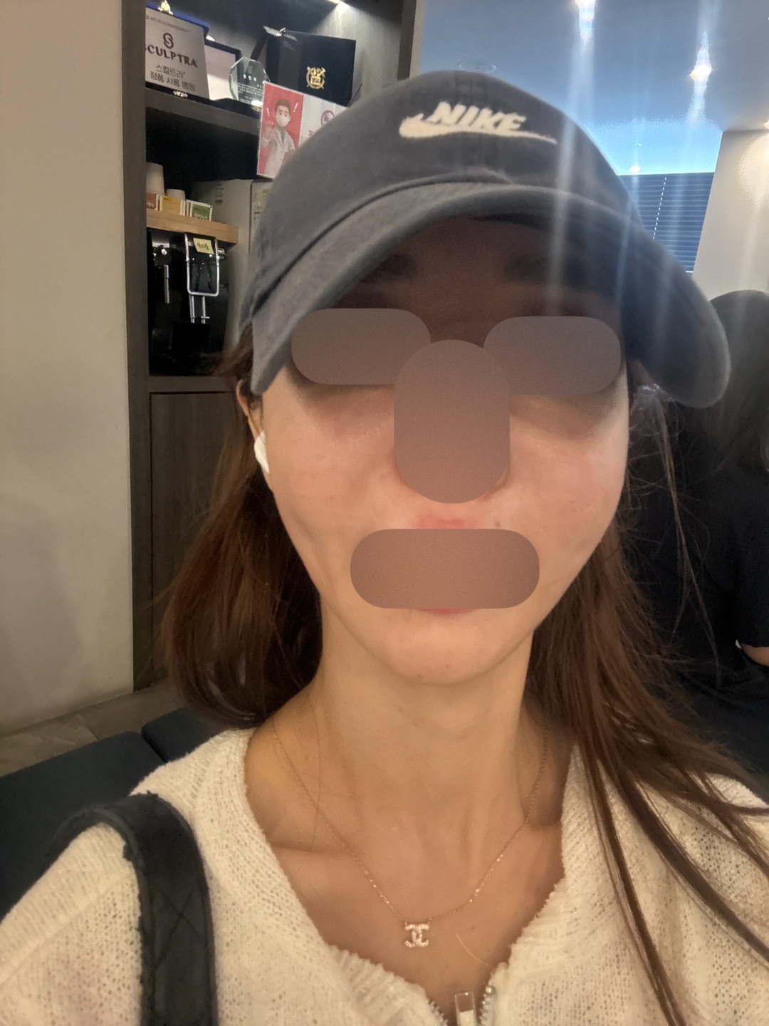 수술후기이미지