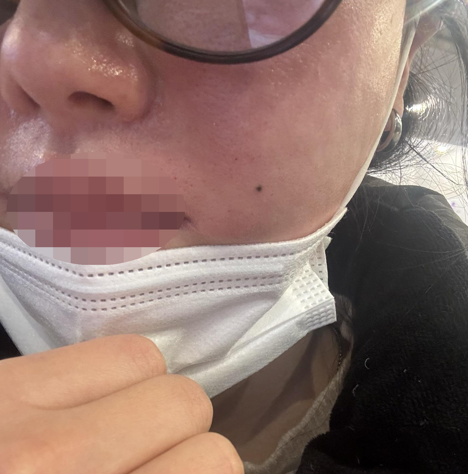 수술후기이미지