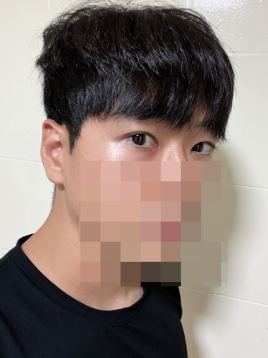 수술후기이미지