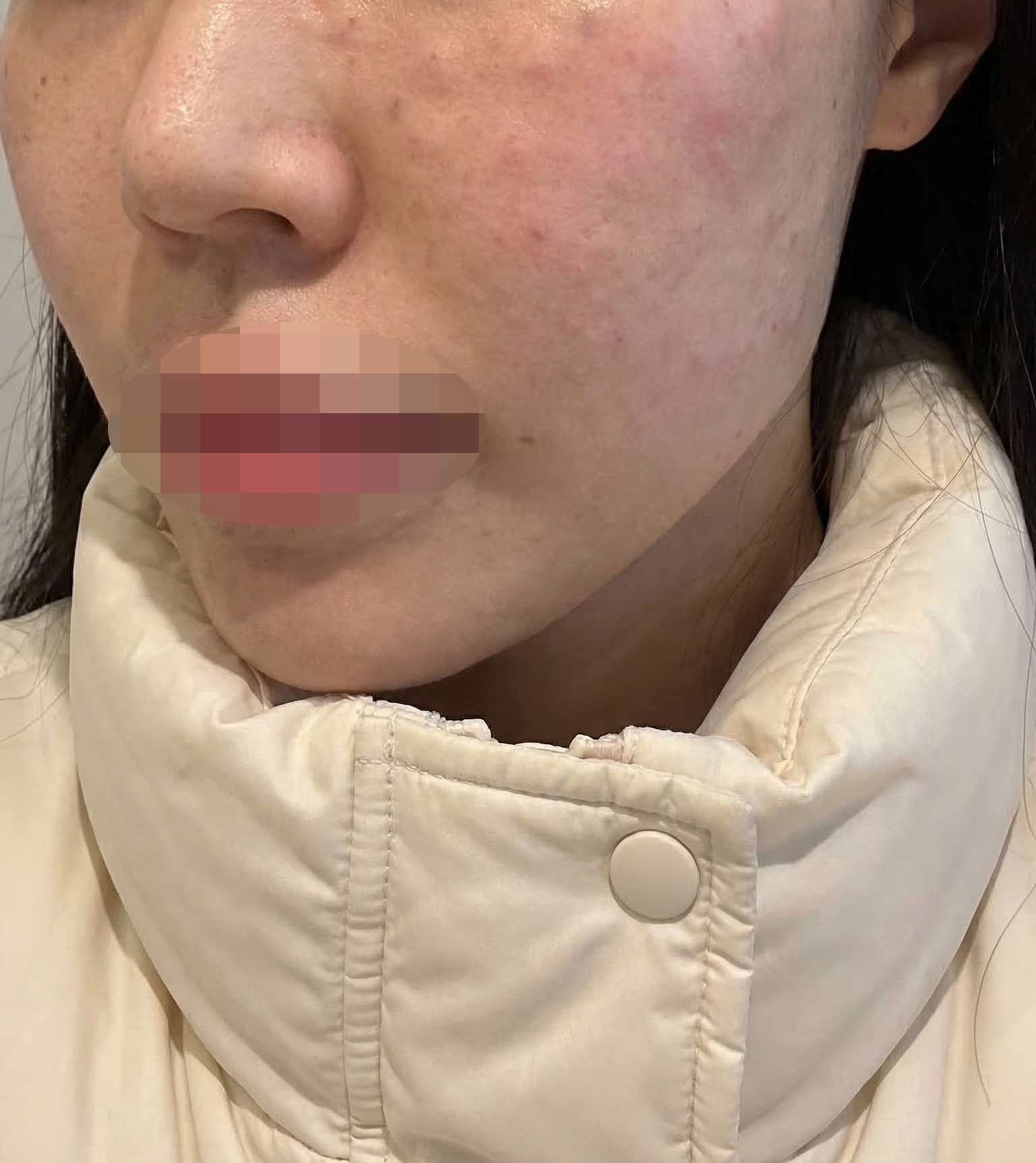 수술후기이미지