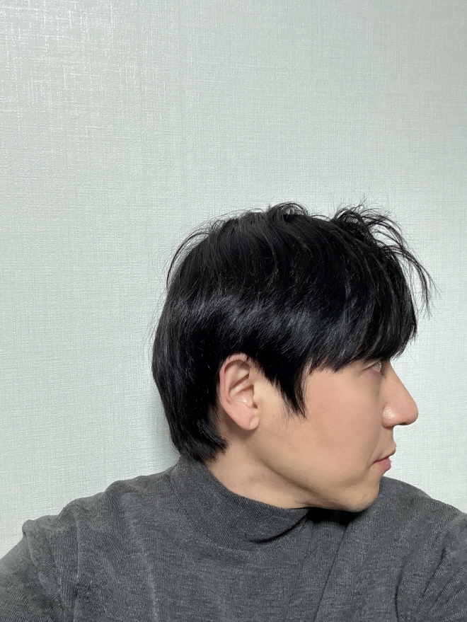 수술후기이미지