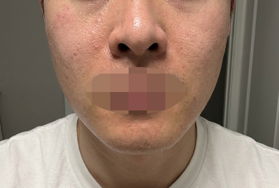 수술후기이미지