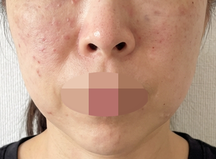 수술후기이미지