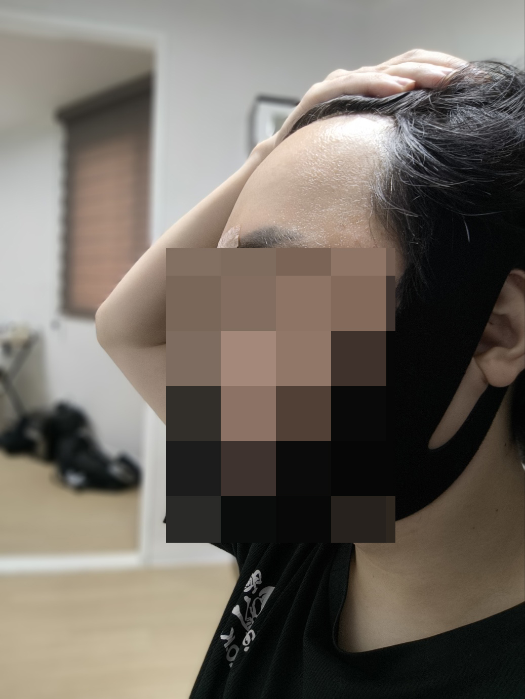 수술후기이미지