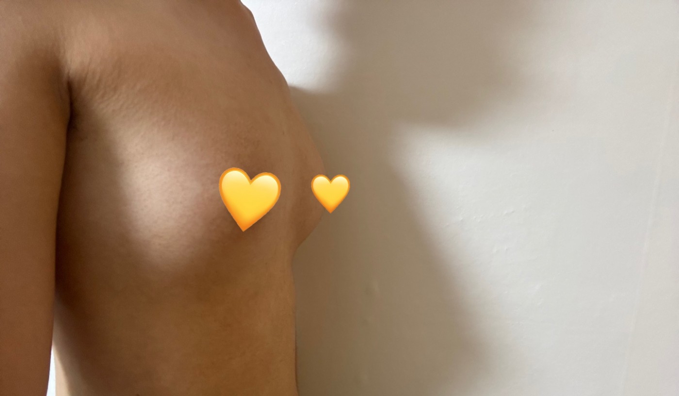 수술후기이미지