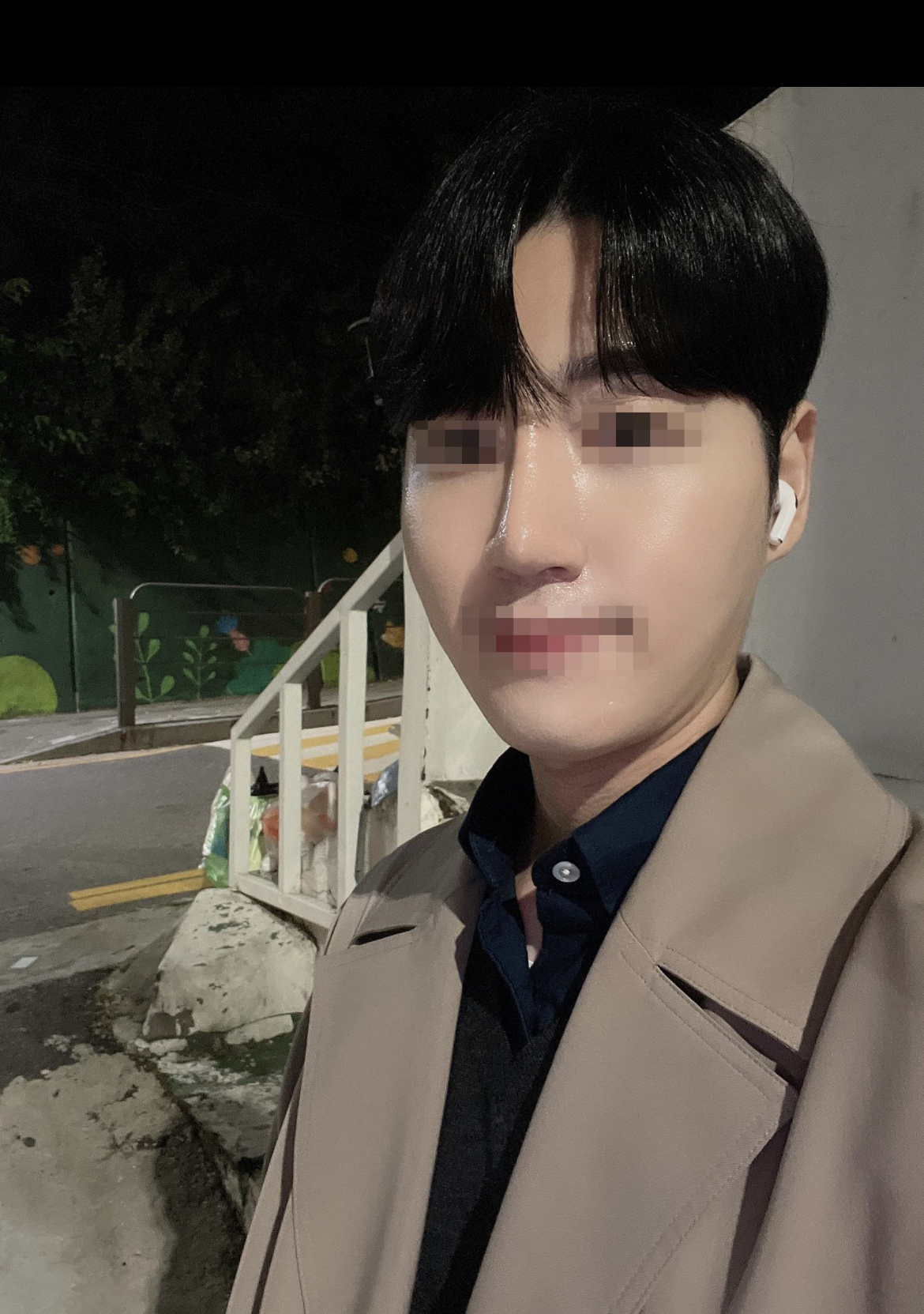 수술후기이미지