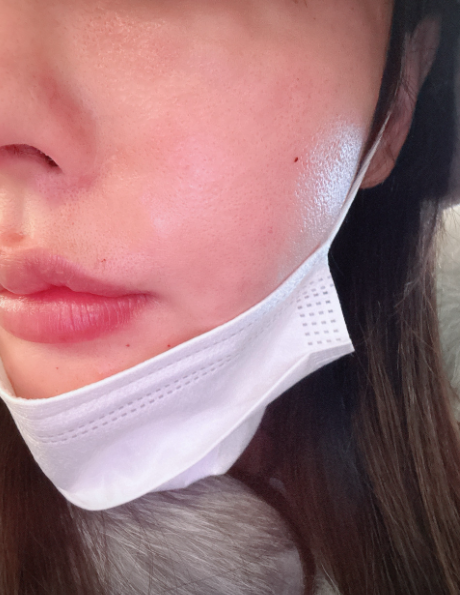 수술후기이미지