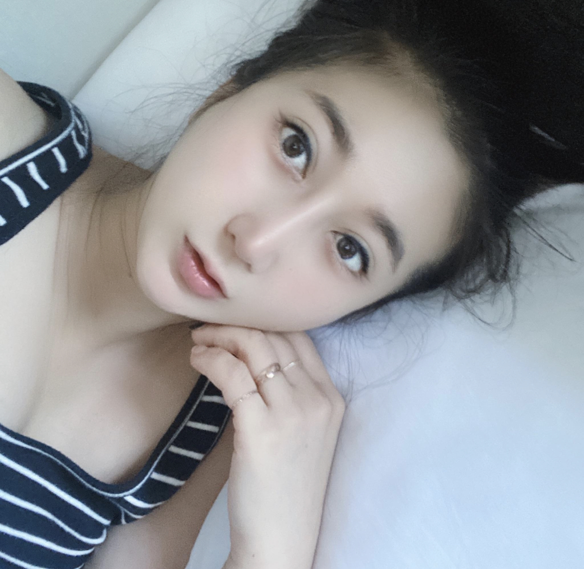 수술후기이미지