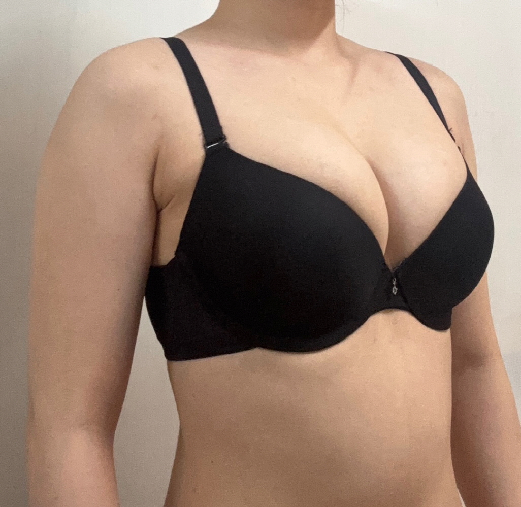 수술후기이미지