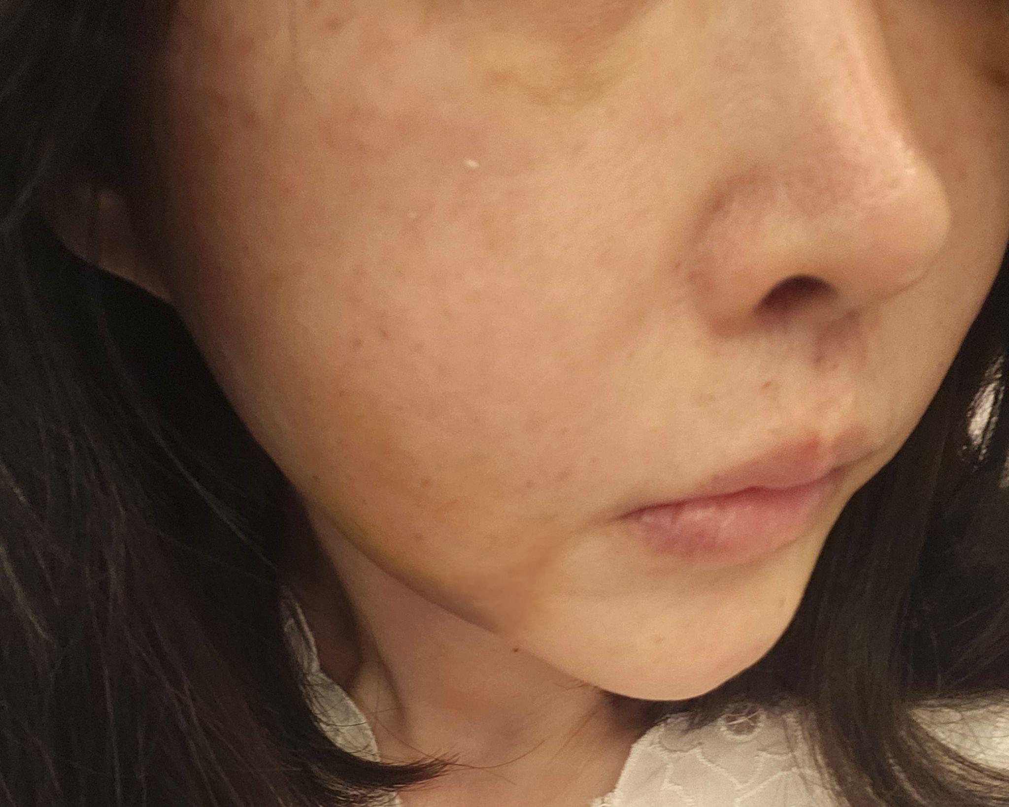 수술후기이미지