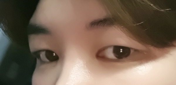 수술후기이미지