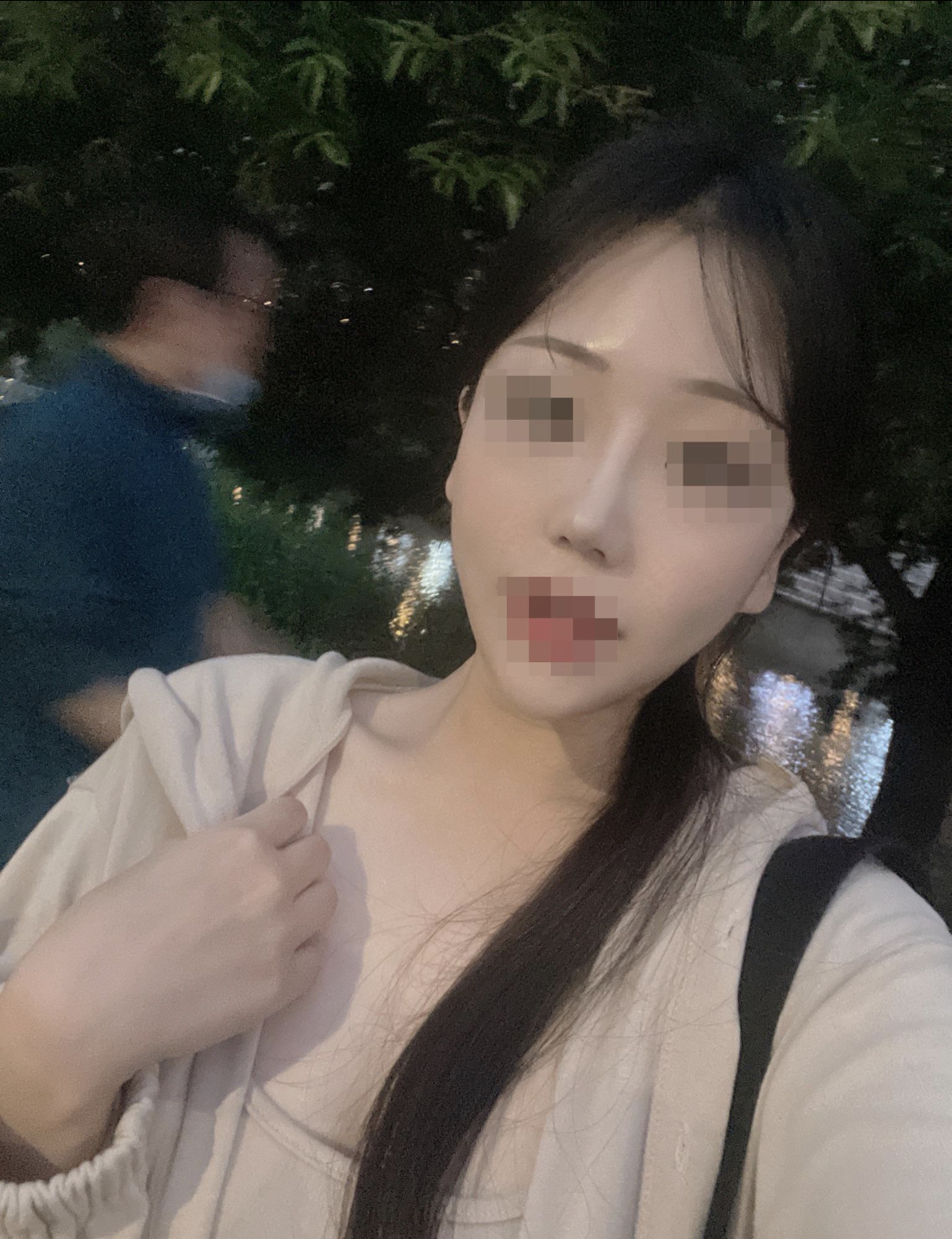 수술후기이미지