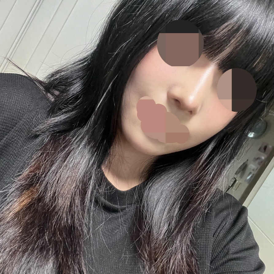 수술후기이미지