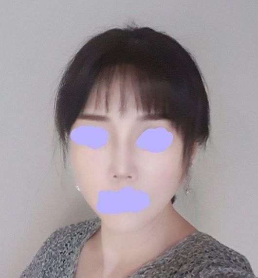 수술후기이미지