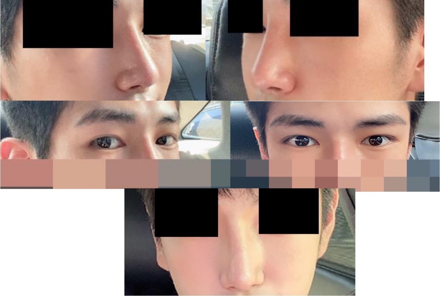 수술후기이미지