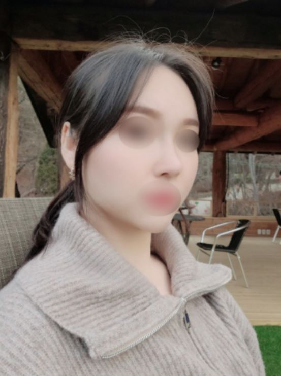 수술후기이미지