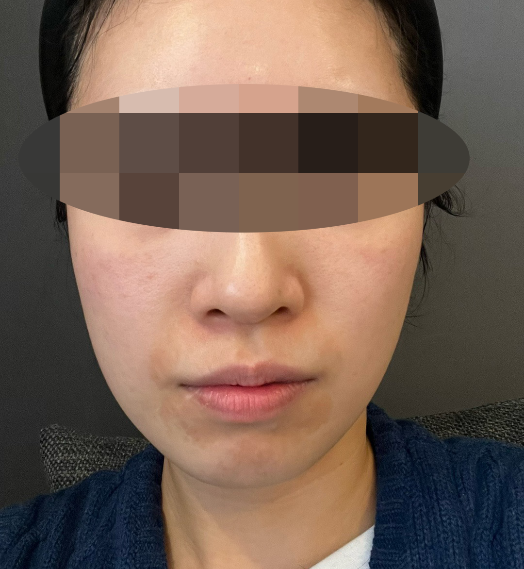 수술후기이미지