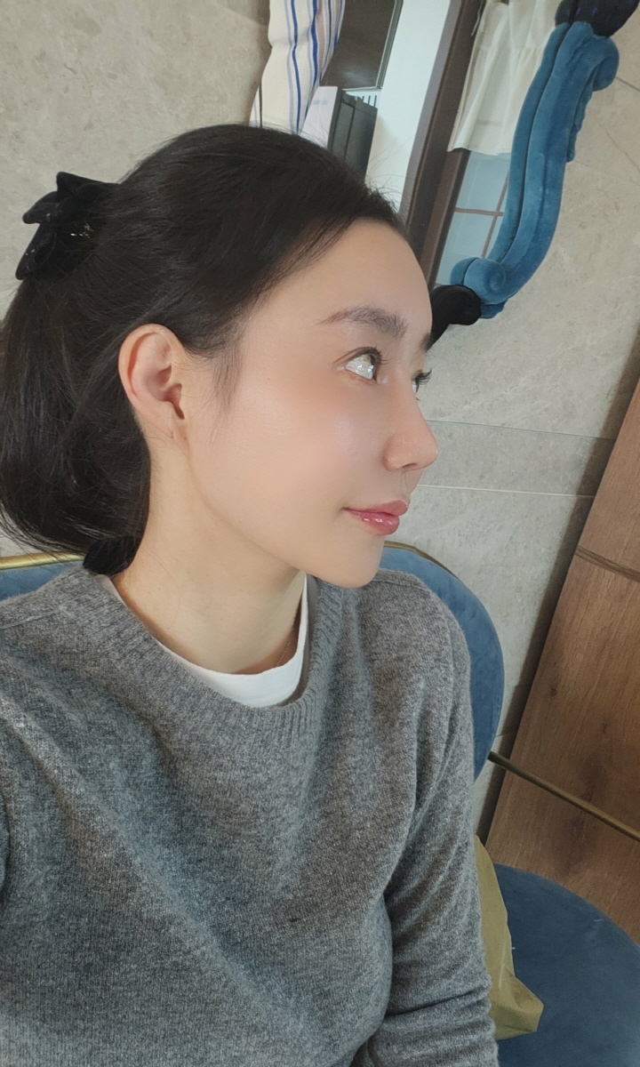 수술후기이미지