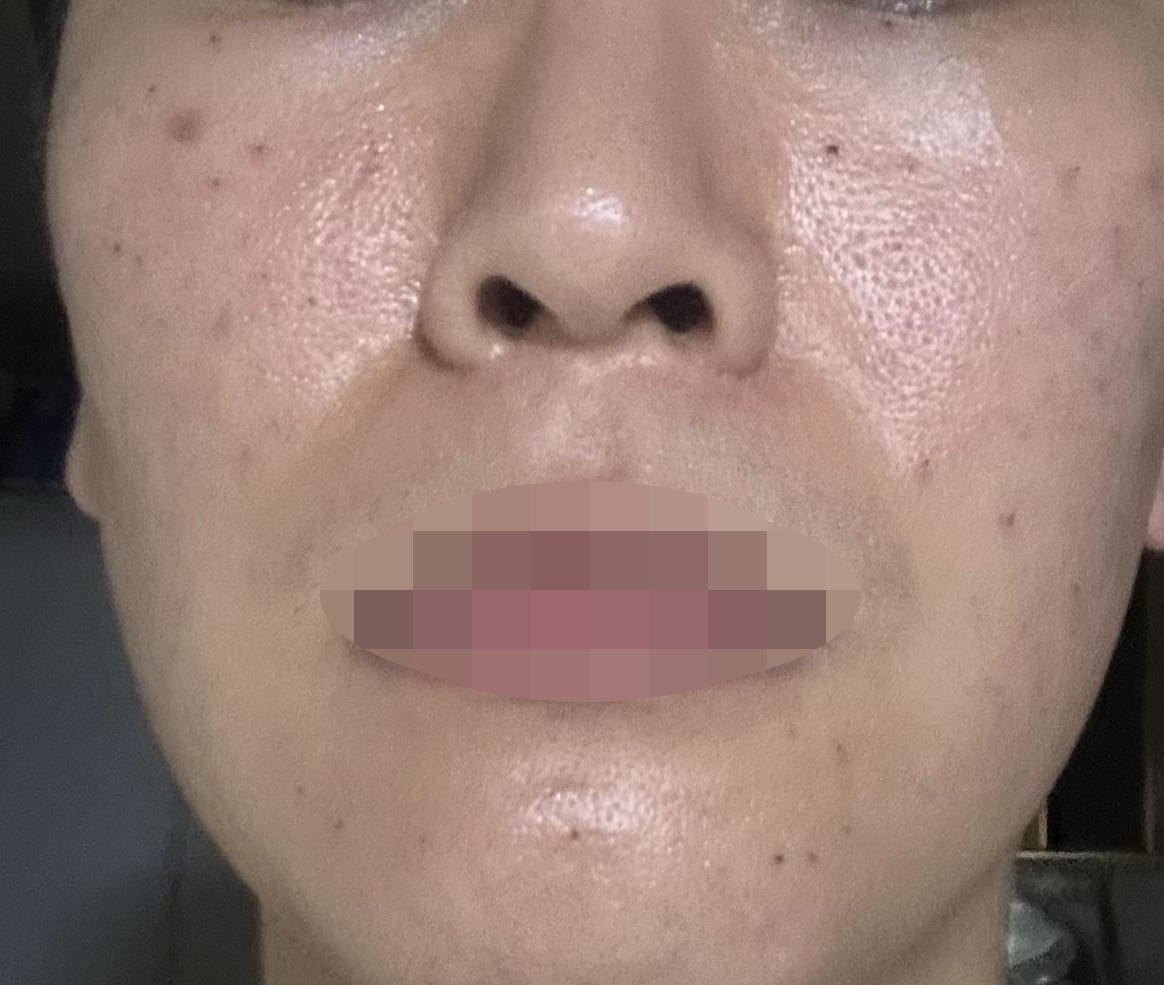 수술후기이미지