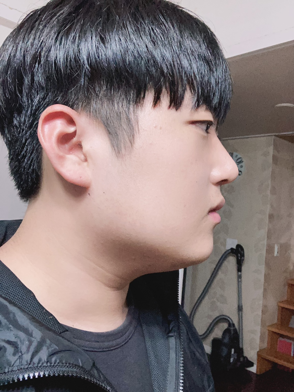 수술후기이미지