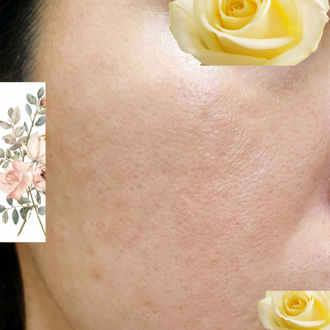 수술후기이미지