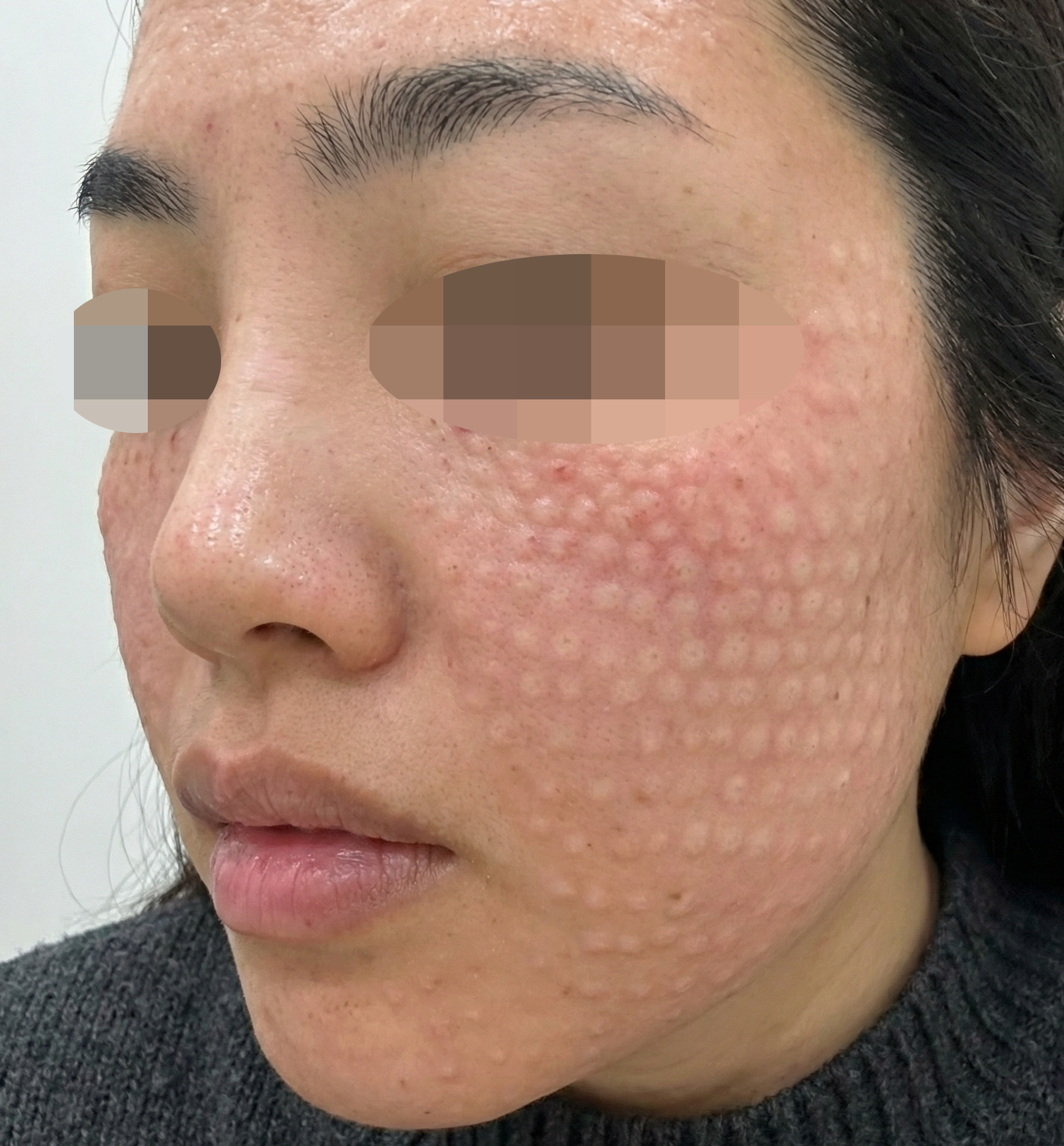 수술후기이미지