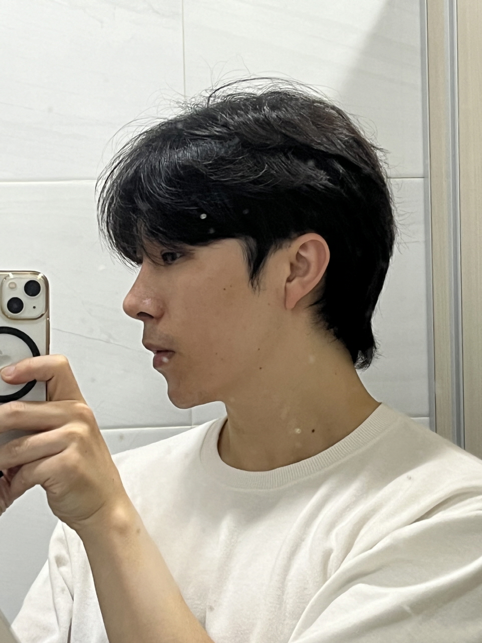 수술후기이미지