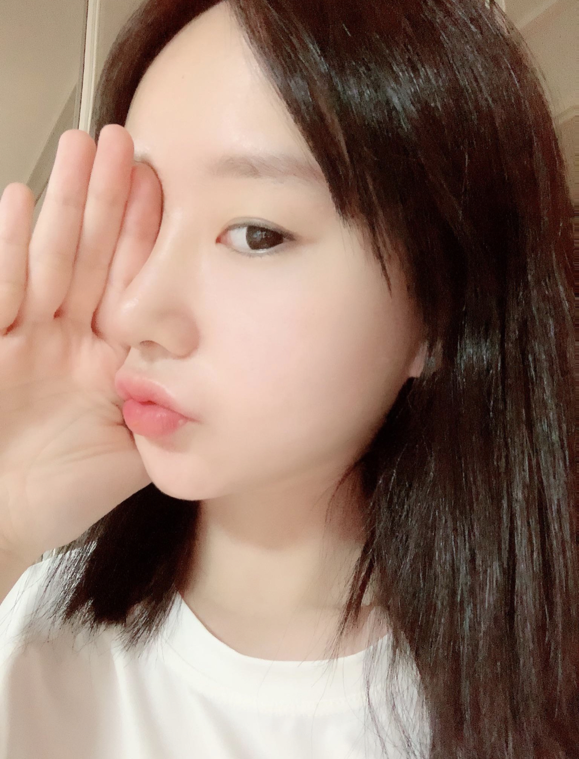 수술후기이미지