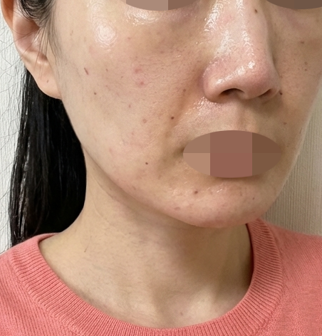 수술후기이미지